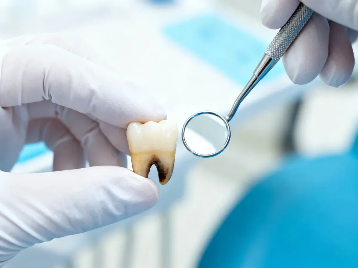 Dentysta oceniający przebarwiony pojedynczy ząb pacjenta